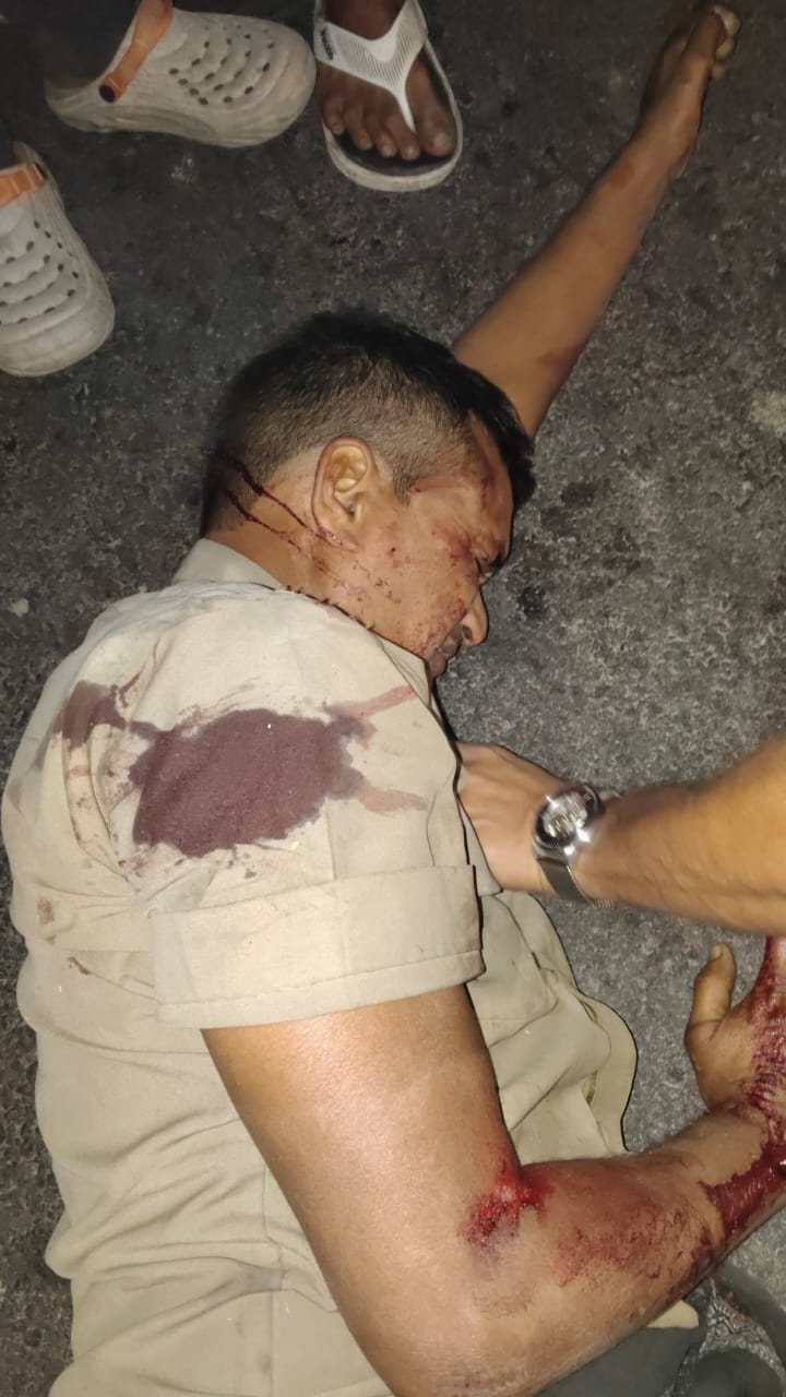 NH-28 पर तेज रफ्तार बस की टक्कर से मजदूर की मौत, पुलिस ने संदिग्ध बस कब्जे में ली