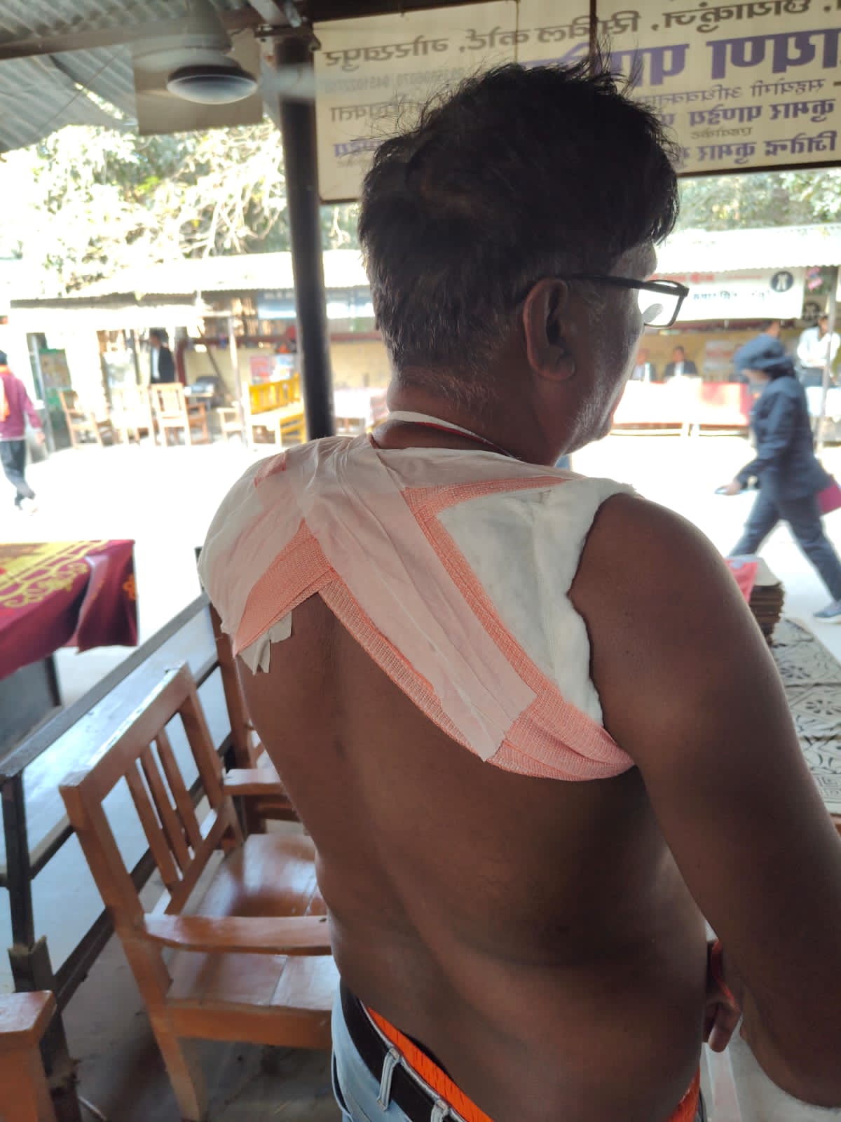 नंदानगर मारपीट प्रकरण में दोनों पक्षों पर दर्ज हुआ मुकदमा गोरखपुर।